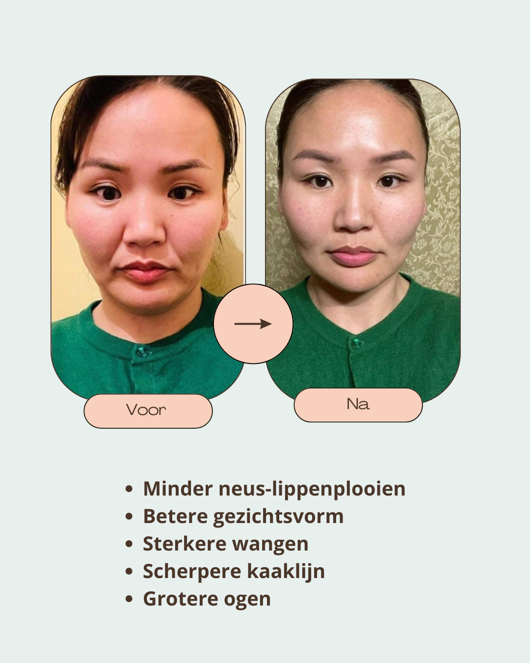 Beige Minimalist Bold Beauty Skincare Before After Collage Instagram Post (1)