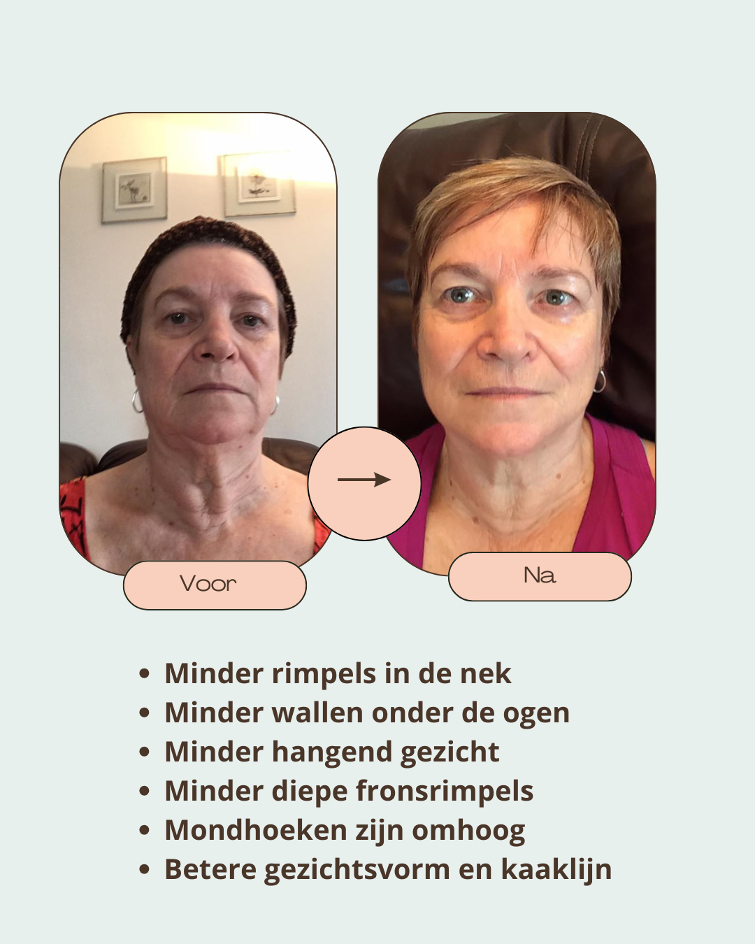 Beige Minimalist Bold Beauty Skincare Before After Collage Instagram Post (2)