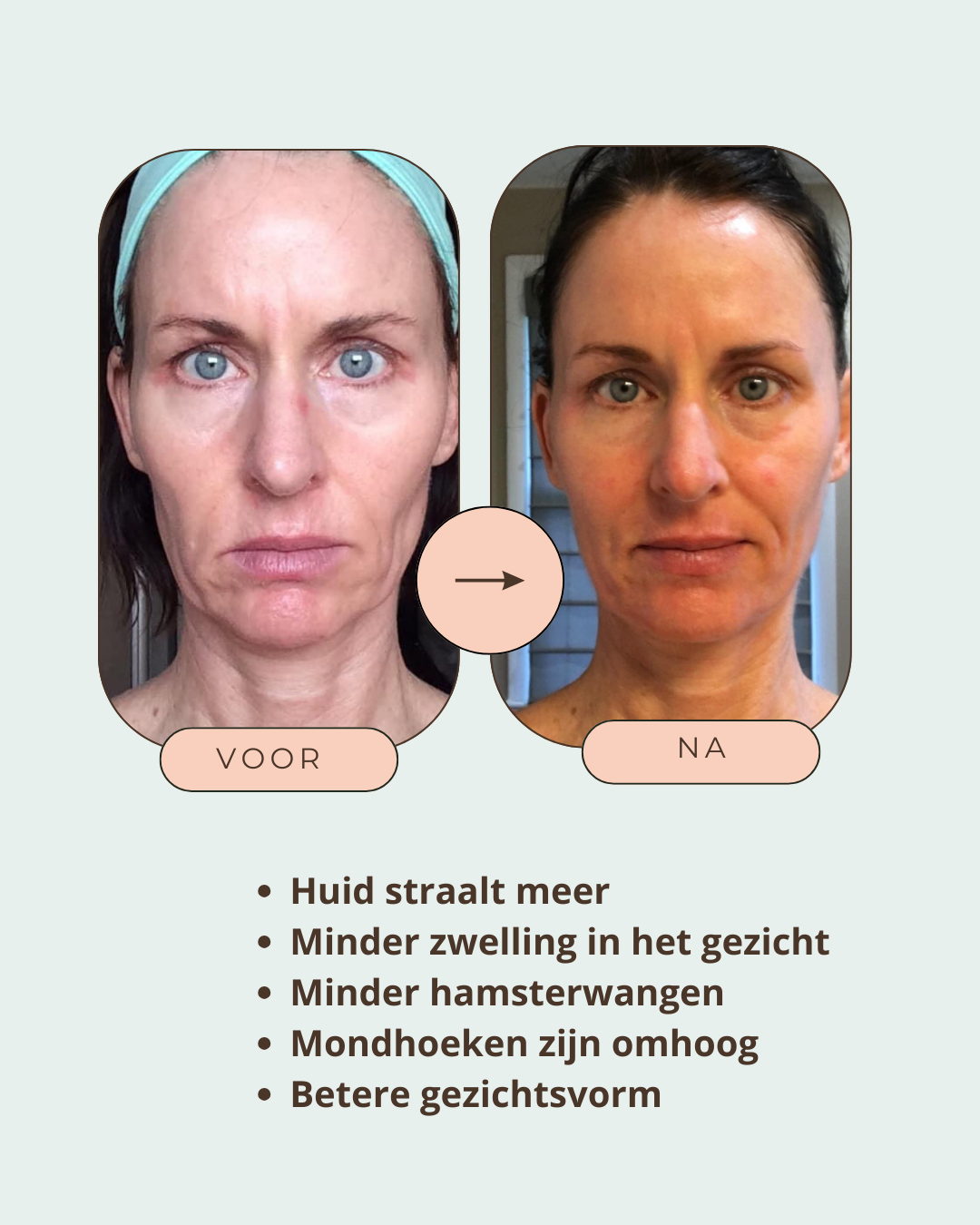 Beige Minimalist Bold Beauty Skincare Before After Collage Instagram Post