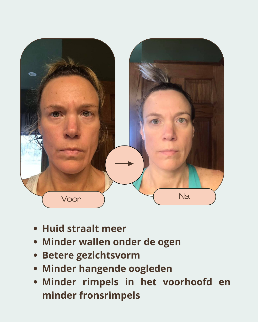 Beige Minimalist Bold Beauty Skincare Before After Collage Instagram Post (3)