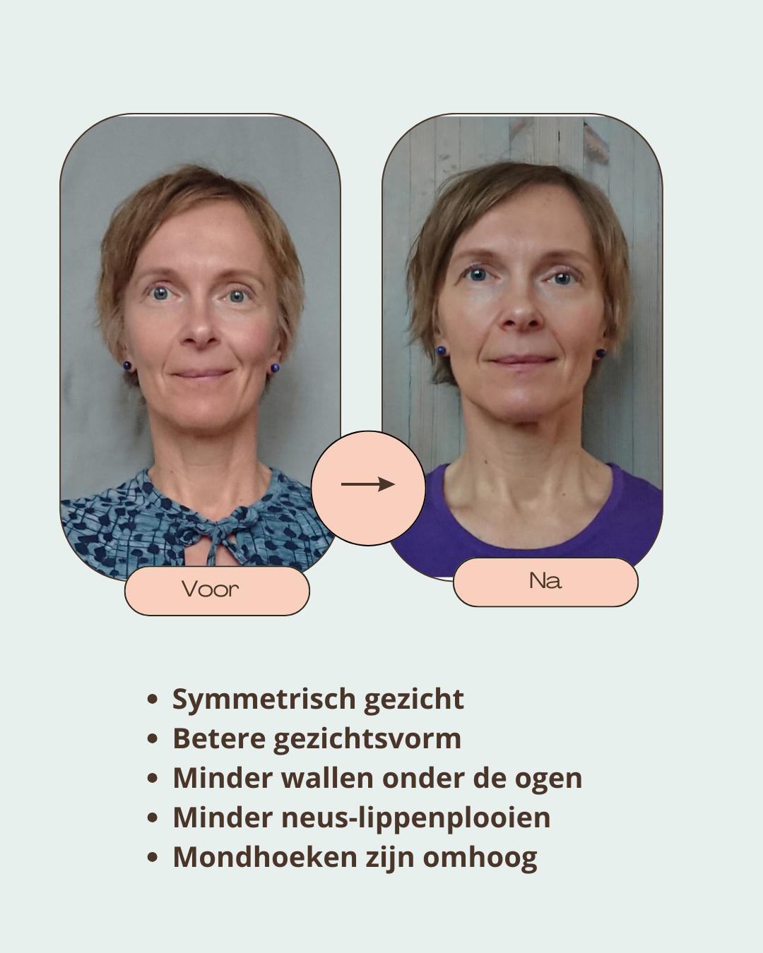 Beige Minimalist Bold Beauty Skincare Before After Collage Instagram Post (4)